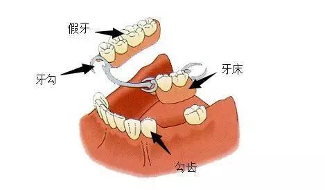 注冊假牙商標(biāo)應(yīng)該選擇商標(biāo)分類中的哪一類？